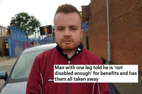 Man with one leg told he is 'not disabled enough' for benefits and has them all taken away