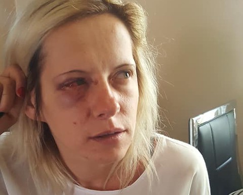 Polish mother 'beaten up by gang of 15 women in racist attack'