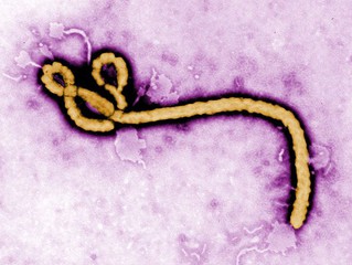 WHO: Coraz mniej przypadków eboli, lecz epidemii jeszcze nie opanowano