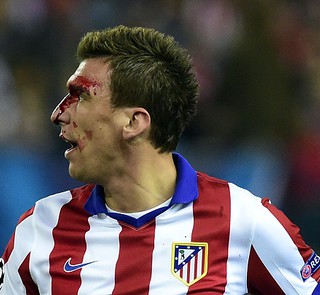 Real Madrid's Dani Carvajal denies biting Atlético's Mario Mandzukic