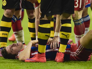 Lewandowski z pękniętą kością twarzy. Polak strzela gola, ale Bayern odpada