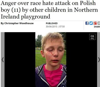 Miasto w Irlandii Płn. w szoku po rasistowskim ataku na polskim chłopcu