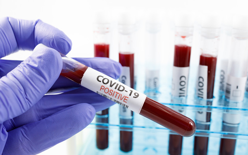 Australian scientists have developed a 20-minute blood test for coronavirus