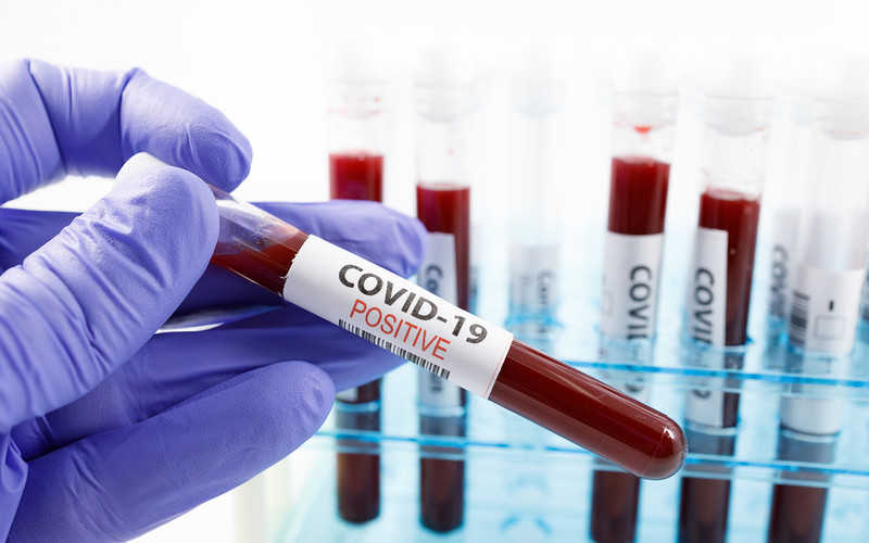 Australijscy naukowcy opracowali 20-minutowy test krwi na koronawirusa