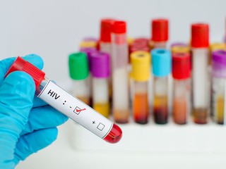 Experts: Only every tenth Pole made HIV test