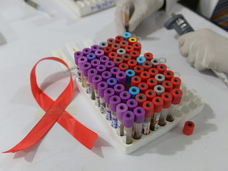 Dzisiaj Światowy Dzień AIDS: Ile zakażonych osób żyje w Polsce?