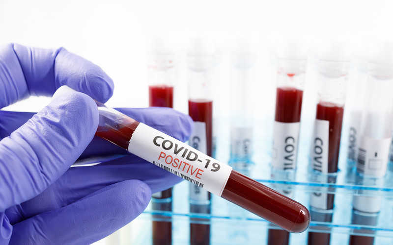 UK records 1,295 daily confirmed cases of COVID-19