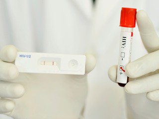 60-sekundowy test na HIV!