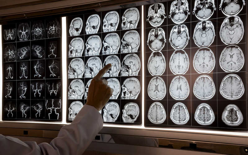 Badania: Koronawirus może uszkadzać mózg, nie wnikając do niego