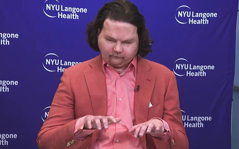 New Jersey man first to receive face and double-hand transplant