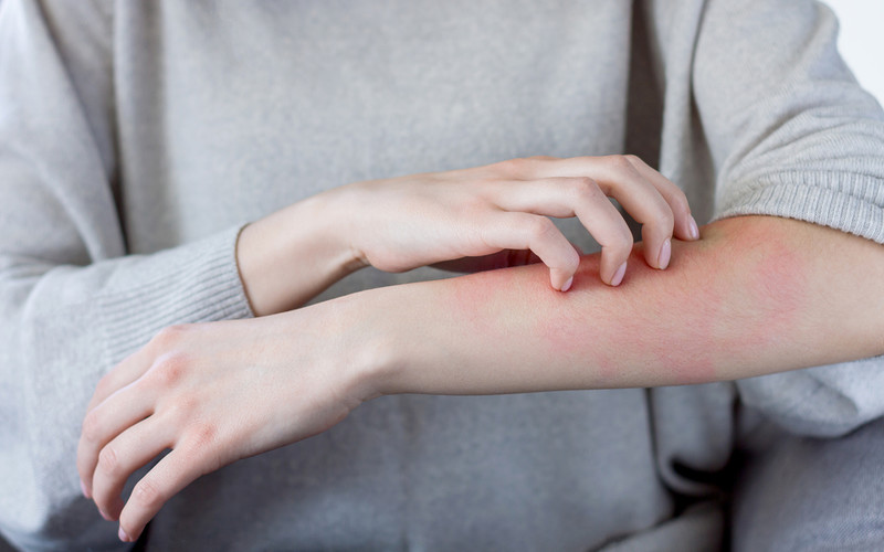Study links unusual skin rashes to Covid-19 infection