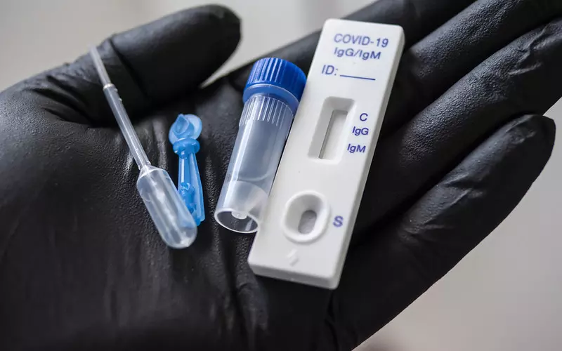 Mieszkańcy UK z koronawirusem otrzymają darmowe testy na przeciwciała