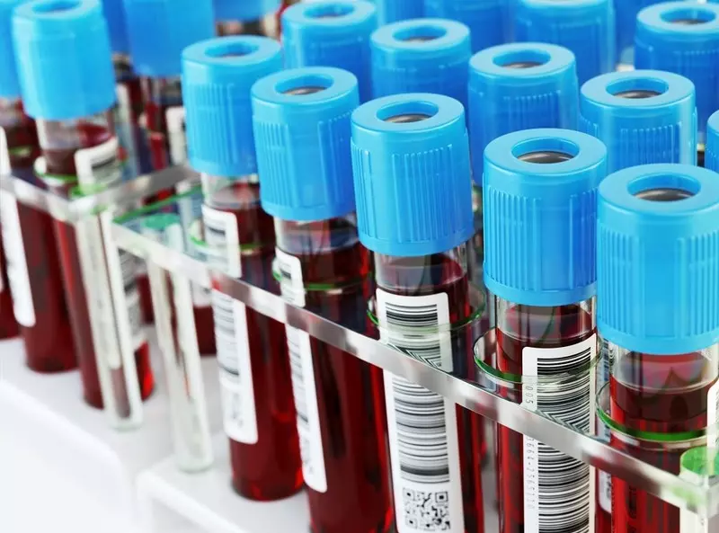 UK zabezpiecza miliony probówek z krwią w obliczu zagrożenia niedoborami