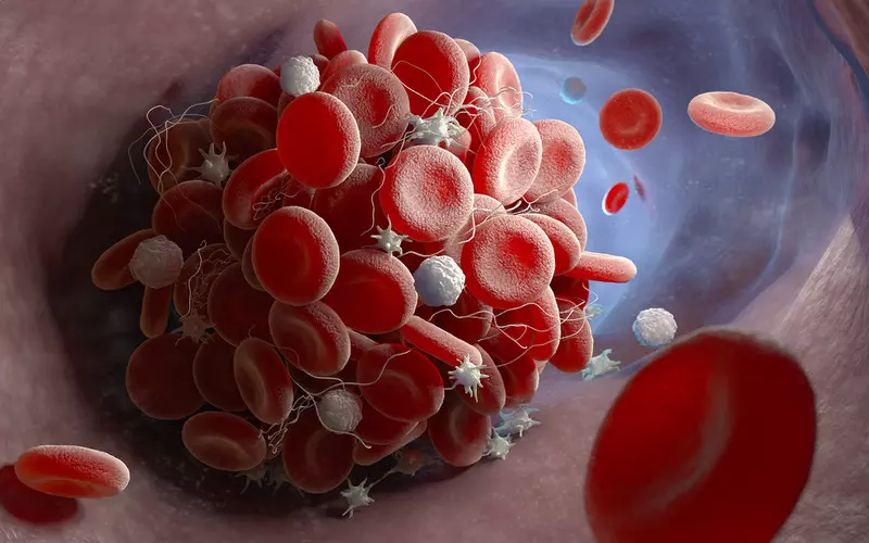Clot risk linked to AstraZeneca vaccine could depend on which blood group you are
