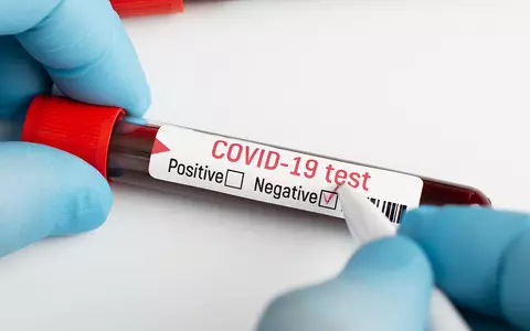 Employers: Instead of testing employees, vaccination verification needed