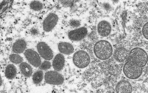 WHO: Monkey pox may spread in Europe with summer parties