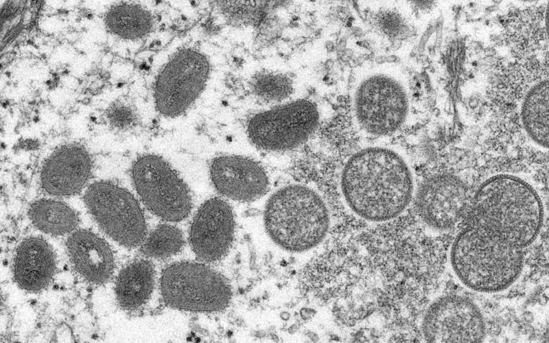 WHO: Monkey pox may spread in Europe with summer parties