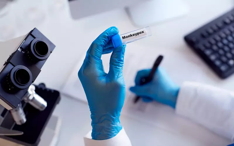 Eksperci: Krążący ostatnio po świecie wirus małpiej ospy nie powstał w żadnym laboratorium