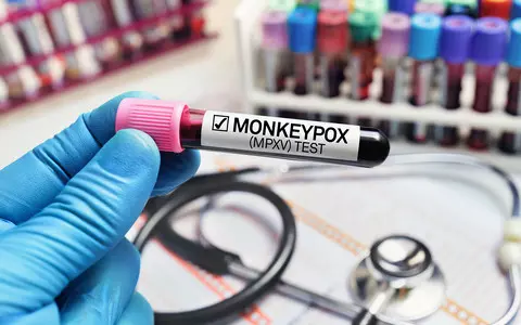 UK monkeypox outbreak is biggest outside Africa and still growing