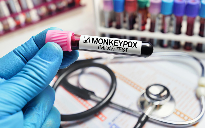 UK monkeypox outbreak is biggest outside Africa and still growing