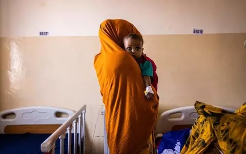 UN: Children in Somalia are starving before our eyes