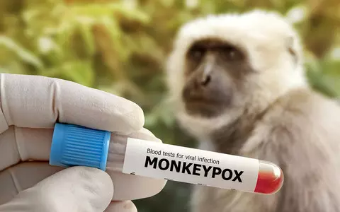 Monkeypox mutating 12 times faster than expected, experts warn