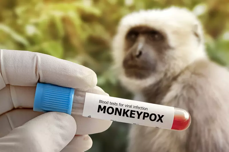 Naukowcy: Małpia ospa mutuje 12 razy szybciej niż przewidywano