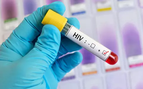 A website with key information on HIV and AIDS has been created