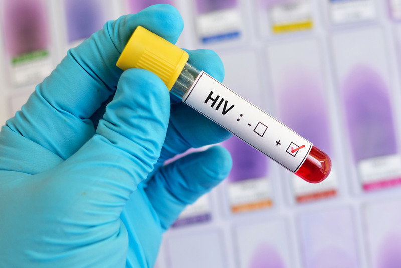 A website with key information on HIV and AIDS has been created