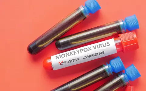 Reuters: Monkeypox detected in 80 countries outside West and Central Africa