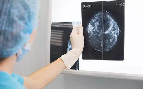 Polish scientists patent method to detect predisposition to aggressive breast cancer