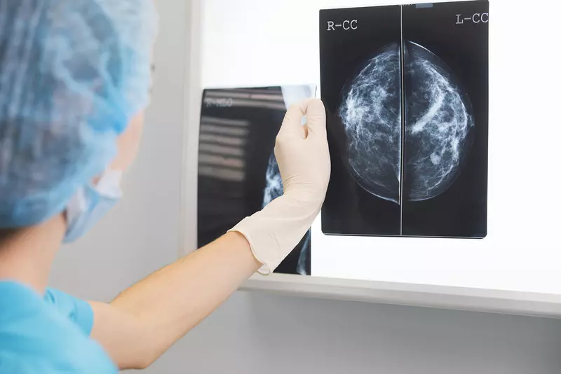 Polscy naukowcy opatentowali metodę wykrywania predyspozycji do agresywnego raka piersi