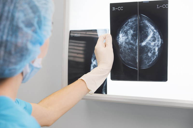 Polish scientists patent method to detect predisposition to aggressive breast cancer