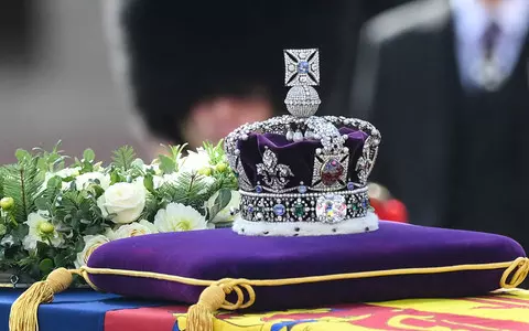 An AR tool which allows one to see in detail the crown that will be placed on the head