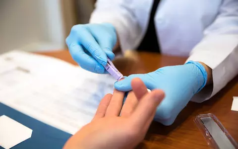 France: The dentist did not sterilize the instruments. HIV tests for 5,000 people