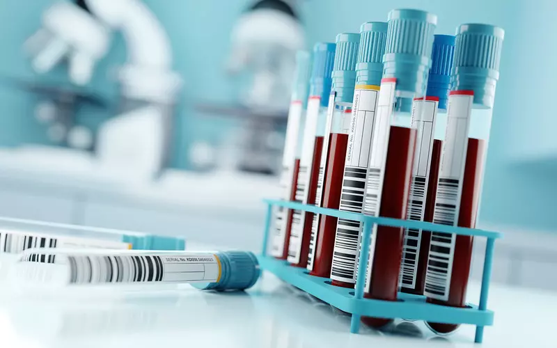 NHS zakończyło testy badania krwi, które pozwala wykryć 50 rodzajów nowotworów