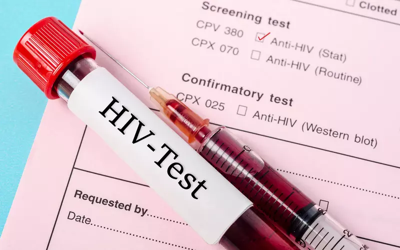 Rutynowe testy na HIV w brytyjskich szpitalach? Pilotażowy program ujawnił setki zakażonych