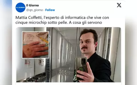 Italy: 35-year-old implanted five microchips in his hand to pay and collect data