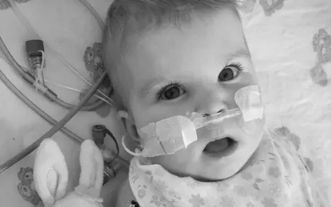 UK: After the court's decision, a terminally ill girl was disconnected from the equipment