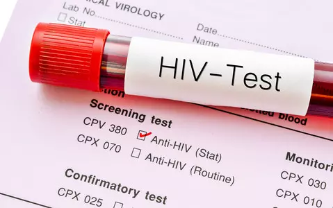 Irlandia: Rośnie liczba zakażeń wirusem HIV wśród kobiet i osób transpłciowych
