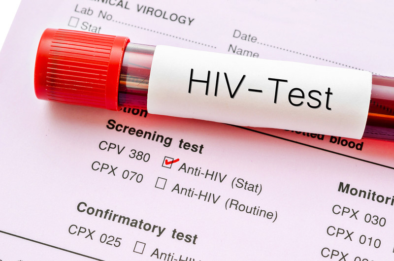 Irlandia: Rośnie liczba zakażeń wirusem HIV wśród kobiet i osób transpłciowych