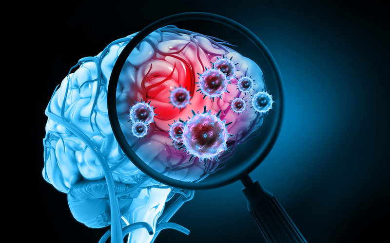 Researchers found specific changes in the brains of patients after COVID-19