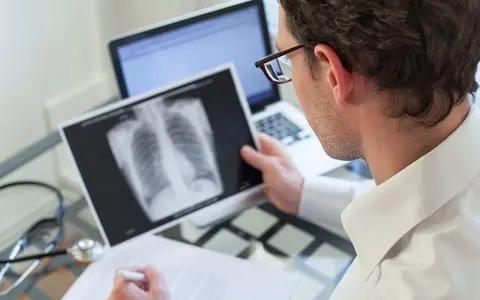 Health experts to probe increase in tuberculosis as cases rise in London and elsewhere