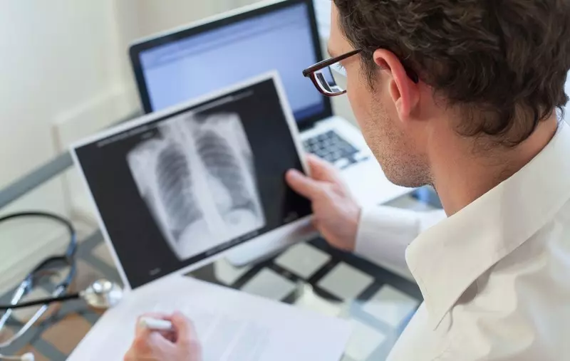 Health experts to probe increase in tuberculosis as cases rise in London and elsewhere