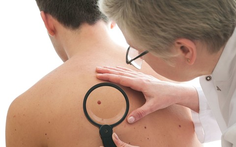 British man tests first personalised melanoma vaccine