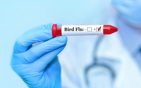 Man in Mexico dies with first human case of H5N2 bird flu