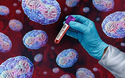 Nowy, śmiertelny szczep wirusa mpox jest "bardzo niepokojący"