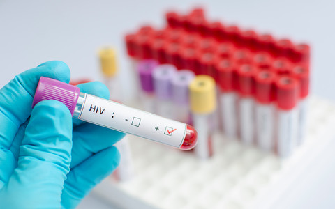 50-70 proc. Polaków zakażonych wirusem HIV nie zdaje sobie z tego sprawy