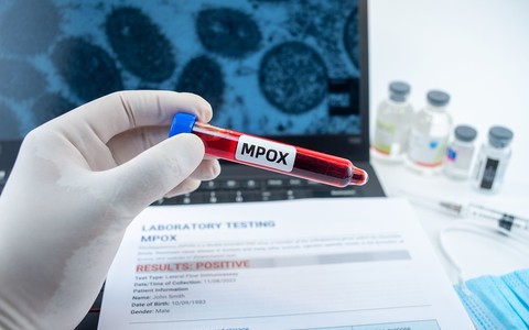 W UK odkryto dwa nowe przypadki bardziej zaraźliwego wirusa mpox