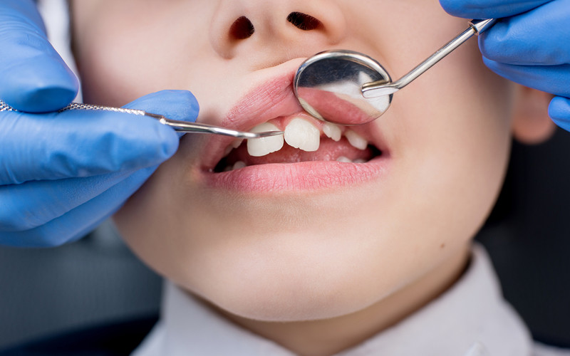 Plan zwiększenia dostępu do usług dentystycznych w ramach NHS w Anglii to "kompletna porażka"